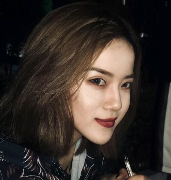 重慶華美下頜角整形術(shù)后兩個月效果