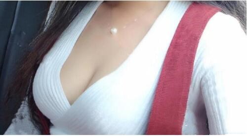 濟(jì)南悅美假體隆胸整形術(shù)后三個(gè)月效果 濟(jì)南悅美假體隆胸整形術(shù)后三個(gè)月效果