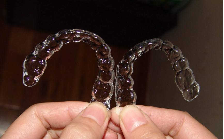 自貢華醫(yī)整形金屬托槽矯正結(jié)束，佩戴保持器