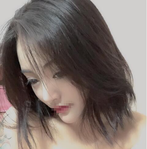 上海賽美瑞整形張化舉鼻綜合一個月效果 上海賽美瑞整形張化舉鼻綜合一個月效果