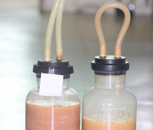 青島大學(xué)醫(yī)學(xué)院附屬醫(yī)院整形美容燒傷科陳振宇雙腿吸脂吸出的脂肪 青島大學(xué)醫(yī)學(xué)院附屬醫(yī)院整形美容燒傷科陳振宇雙腿吸脂吸出的脂肪