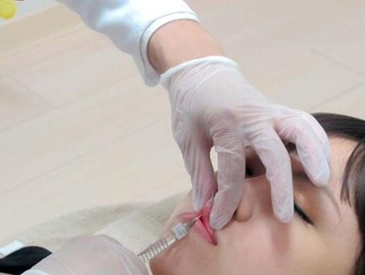 杭州藝涵整形玻尿酸豐唇中 杭州藝涵整形玻尿酸豐唇中