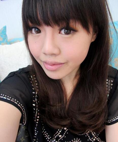 杭州藝涵整形玻尿酸豐唇后效果 杭州藝涵整形玻尿酸豐唇后效果