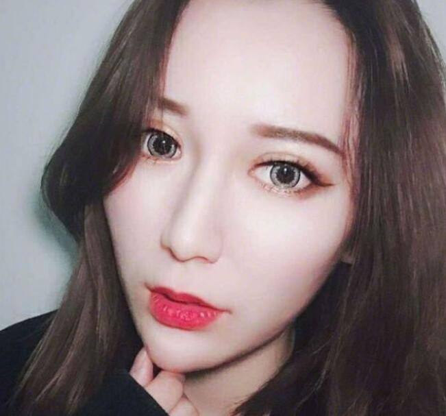 上海藝星整形崔海天下頜角整形術(shù)后兩個月效果 上海藝星整形崔海天下頜角整形術(shù)后兩個月效果