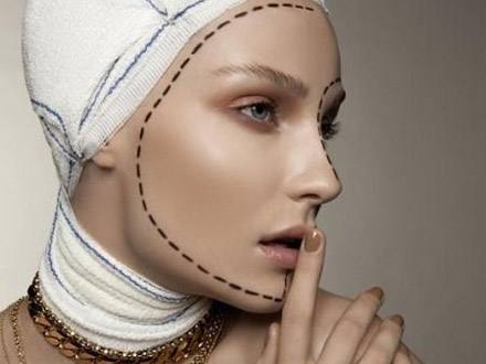 東北國際醫(yī)院整形下頜角整形術(shù)后效果