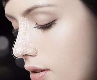 大連醫(yī)科大學(xué)附屬第一醫(yī)院做自體軟骨隆鼻術(shù)后效果