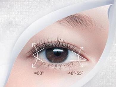 哈爾濱三精女子?？普伍_眼角術(shù)后效果