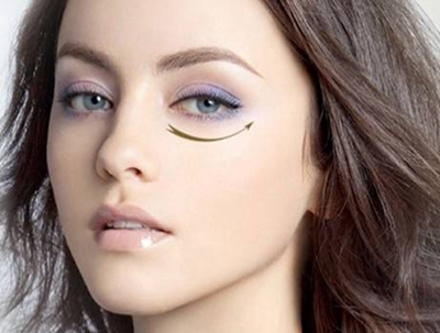 南京美利林整形美容醫(yī)院激光祛眼袋