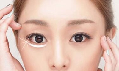 南京美范整形激光祛眼袋