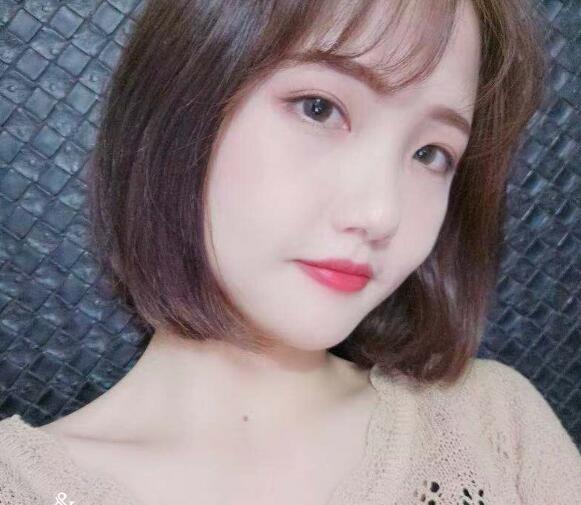 做切開雙眼皮恢復中的我 做切開雙眼皮恢復中的我