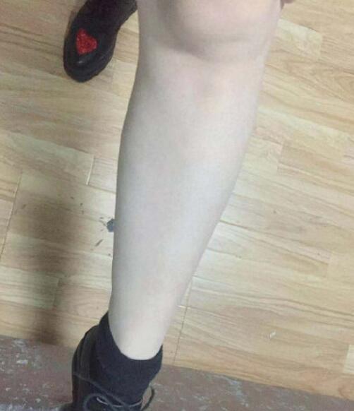 宋君醫(yī)生激光脫毛手術(shù)最終效果圖對(duì)比 宋君醫(yī)生激光脫毛手術(shù)最終效果圖對(duì)比