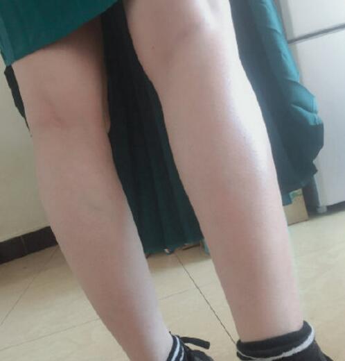 宋君醫(yī)生激光脫毛手術(shù)效果 宋君醫(yī)生激光脫毛手術(shù)效果