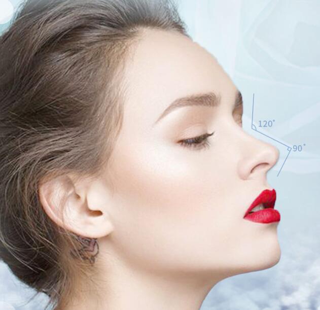 北京博士園整形醫(yī)生郭以文假體隆鼻修復(fù)案例 北京博士園整形醫(yī)生郭以文假體隆鼻修復(fù)案例