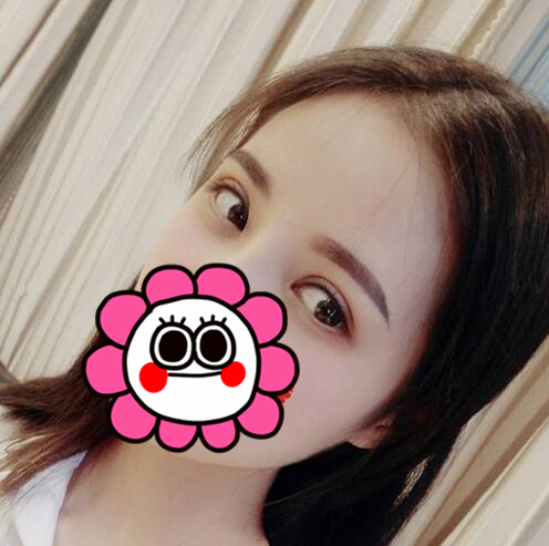 雙眼皮手術(shù)恢復(fù)過程中