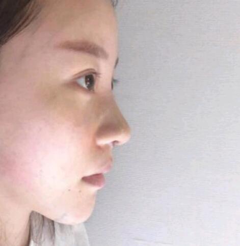 手術(shù)之后 手術(shù)之后