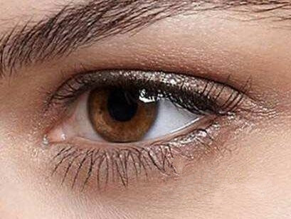 上海港華醫(yī)療美容醫(yī)院激光祛眼袋