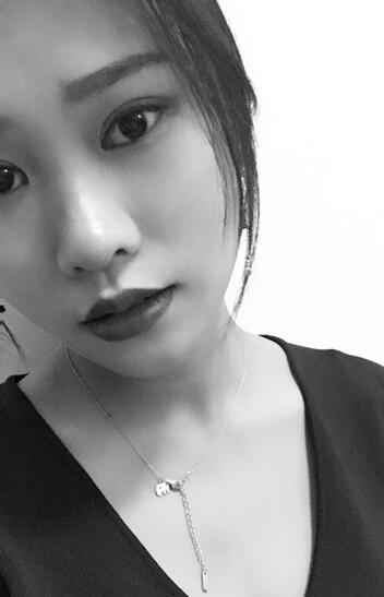 上海伊美爾港華整形醫(yī)生師麗麗做雙眼皮怎么樣？師麗麗雙眼皮案例分享