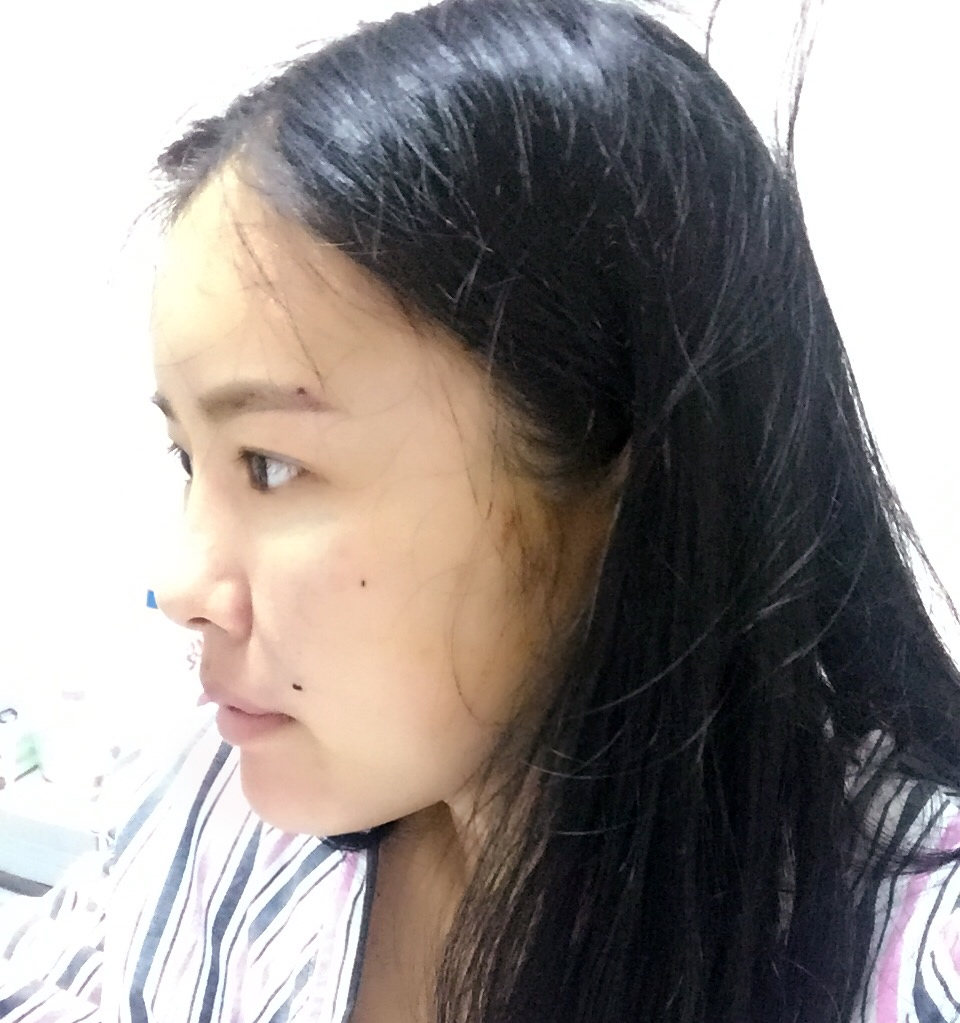 手術(shù)當(dāng)天