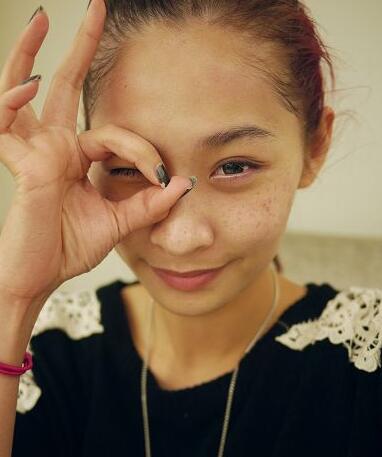 手術(shù)一周后 手術(shù)一周后