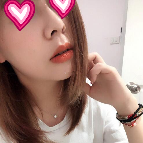 西安儷人醫(yī)院整形醫(yī)生蘇鵬做隆鼻技術(shù)怎么樣？附蘇鵬醫(yī)生隆鼻案例