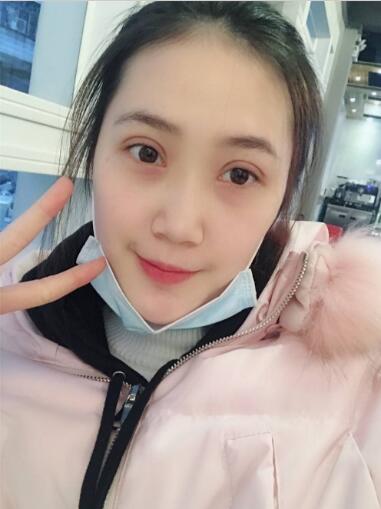 手術(shù)兩周后