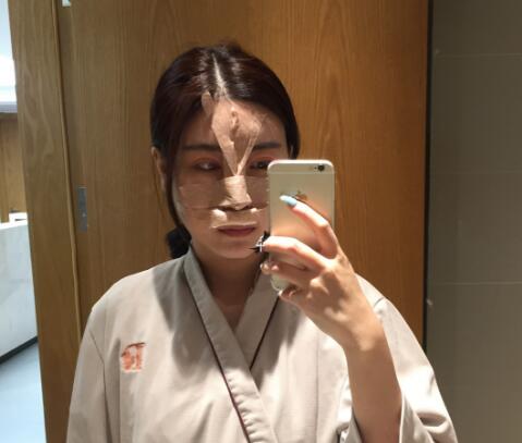 鼻綜合整形手術時