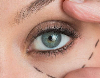 濰坊醫(yī)學(xué)院附屬醫(yī)院整形外科激光祛黑眼圈