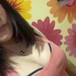 南寧伊美整形醫(yī)生凌宏量做自體脂肪隆胸怎么樣？自體脂肪隆胸案例