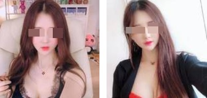 沈陽杏林整形美容醫(yī)院崔昌墉醫(yī)生做假體隆胸技術(shù)怎么樣？附案例