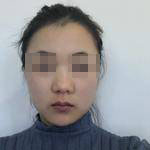 術(shù)前照片 術(shù)前照片