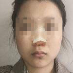 恢復過程 恢復過程