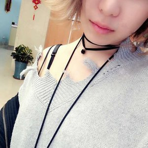 孫軼峰做假體隆胸案例效果對比圖 孫軼峰做假體隆胸案例效果對比圖