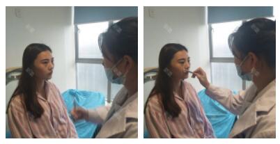 上海首爾麗格整形醫(yī)生魯峰一做自體脂肪全臉填充