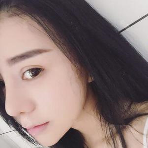 硅膠隆鼻第12天 硅膠隆鼻第12天