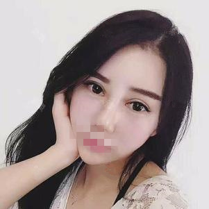 硅膠隆鼻第29天 硅膠隆鼻第29天