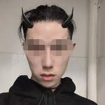 術(shù)后照片 術(shù)后照片