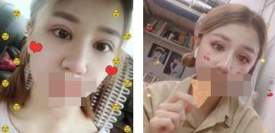 做了全切雙眼皮不僅外表變美了，內(nèi)心也更加自信了