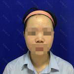 術(shù)前照片 術(shù)前照片