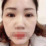 手術(shù)中的照片 手術(shù)中的照片