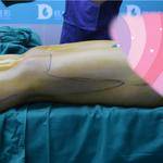 做完雙腿吸脂手術(shù)，穿上我的長(zhǎng)筒靴，盡顯女性魅力！