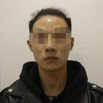 術(shù)前照片 術(shù)前照片