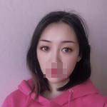 做完雙眼皮手術(shù)眼睛更加迷人了，眼睛自己會撩小哥哥