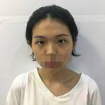 手術(shù)前的照片