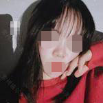 玻尿酸隆鼻讓我的鼻子更加“挺翹”