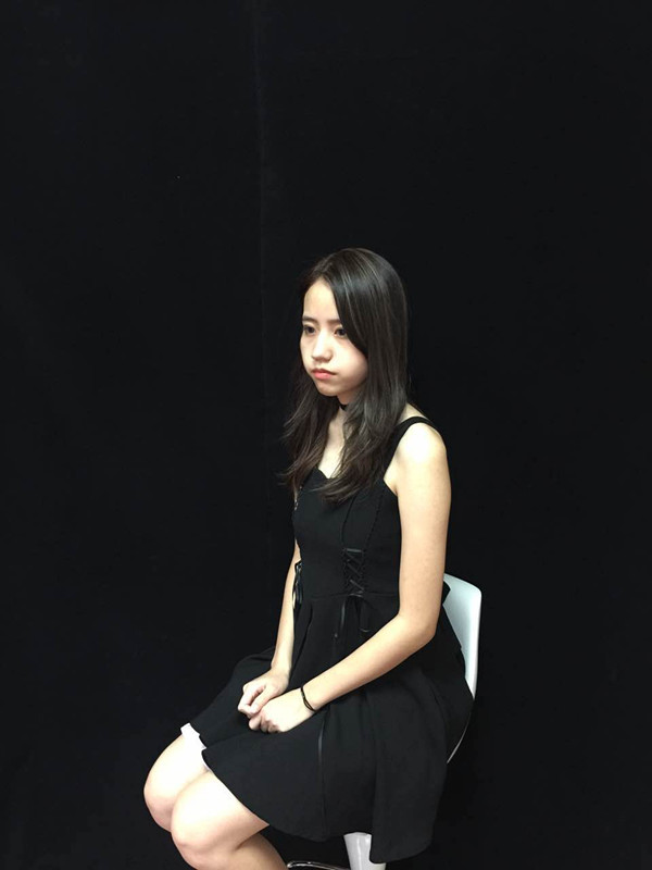 佛山曙光金子醫(yī)學(xué)整形醫(yī)生劉洲尉做埋線隆鼻技術(shù)怎么樣？附案例