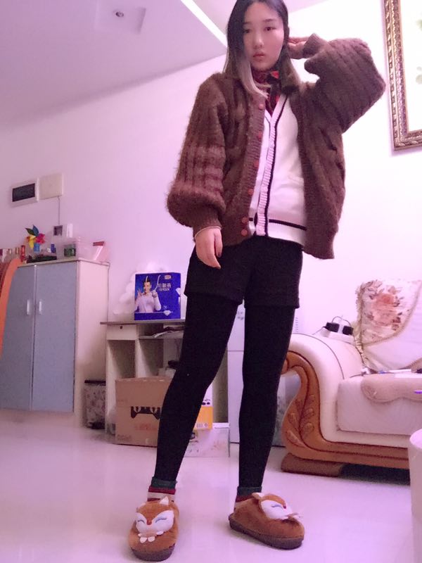 成都美立方整形醫(yī)院黃華醫(yī)生做大腿吸脂怎么樣？附大腿吸脂案例