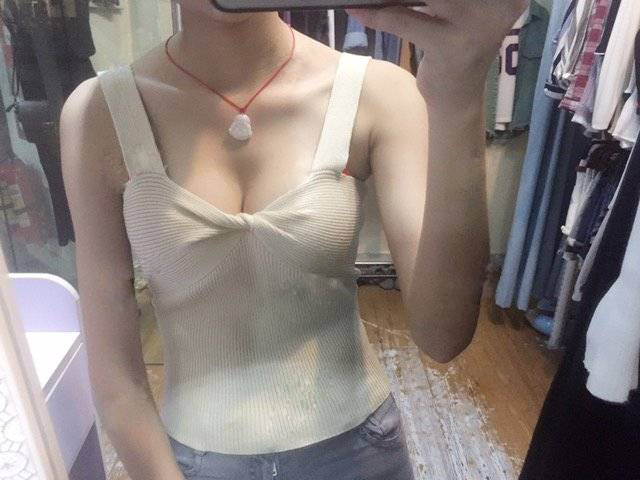 嘉興華山醫(yī)療美容醫(yī)院做假體隆胸怎么樣？嘉興華山陳榮忠假體隆胸案例