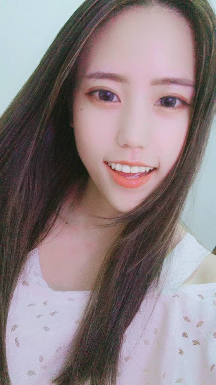 術(shù)后第七天，鼻子已經(jīng)不腫了