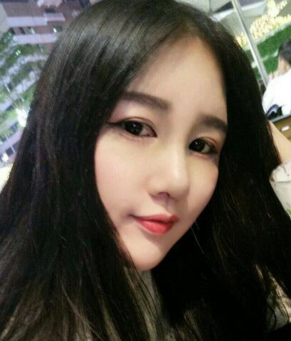 漢中韓美整形醫(yī)生常雙模假體隆鼻+耳軟骨墊鼻尖真實案例效果圖