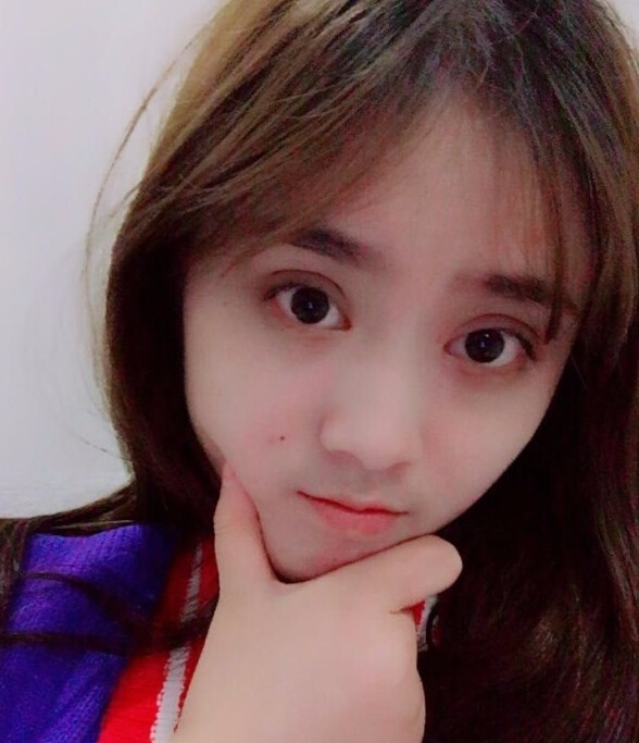 福州愛(ài)美爾整形醫(yī)院黃林勝醫(yī)生做雙眼皮技術(shù)怎么樣？雙眼皮案例效果展示